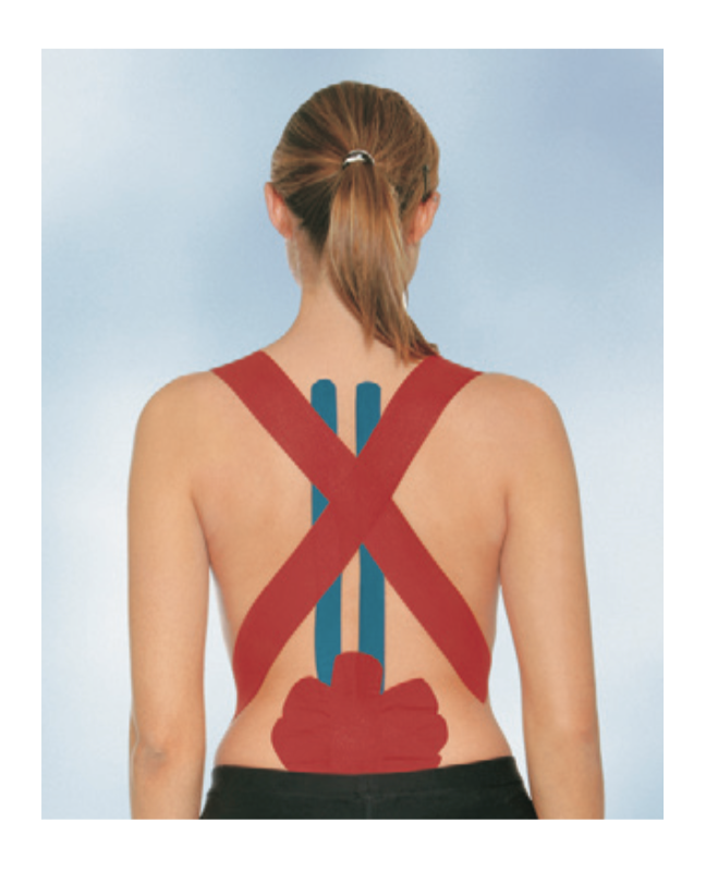 BSN Medical Leukotape K - Kinesio Therapeutic Adhesive Tape